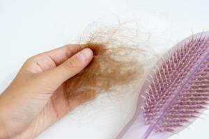 postpartum hair loss symptoms